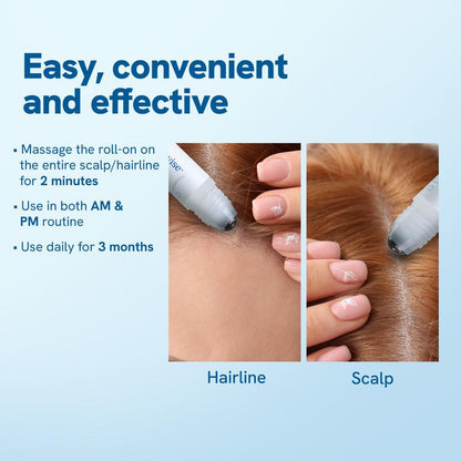 Mana -  Advanced Hair Growth Roll On Serum